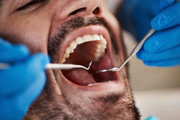 Best Dentist for Tooth Abscess  in Leipsic, OH
