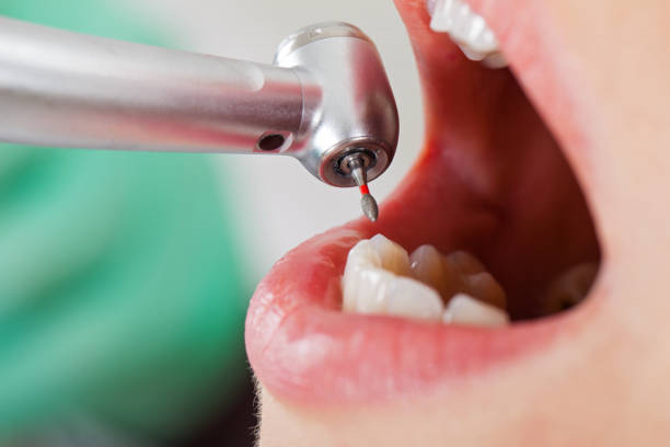 Best Dentist for Severe Toothache  in Leipsic, OH